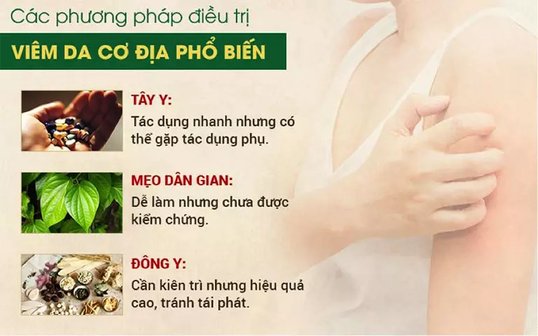 Các phương pháp điều trị viêm da cơ địa