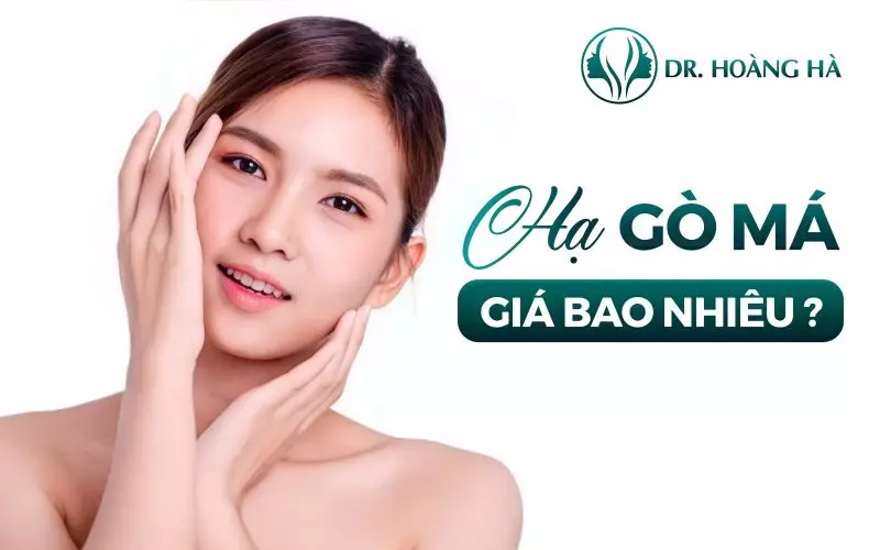 Hình ảnh minh họa về hạ gò má