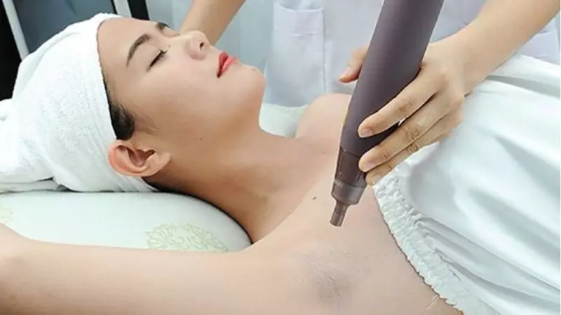 Sử dụng laser để loại bỏ vùng da tổn thương